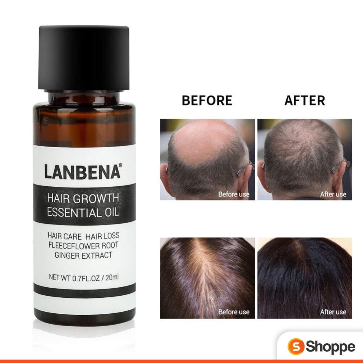 LANBENA Hair Growth Oil | SHOPPE.LK