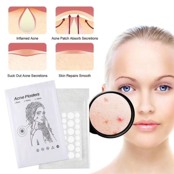 Effective Pimple Removal Patch for Clear Skin - Pack of 36 - SHOPPE.LK