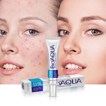 Bioaqua Pure Skin Face Care Acne Treatment Cream - Clear, Smooth, and Radiant Skin - Image 2