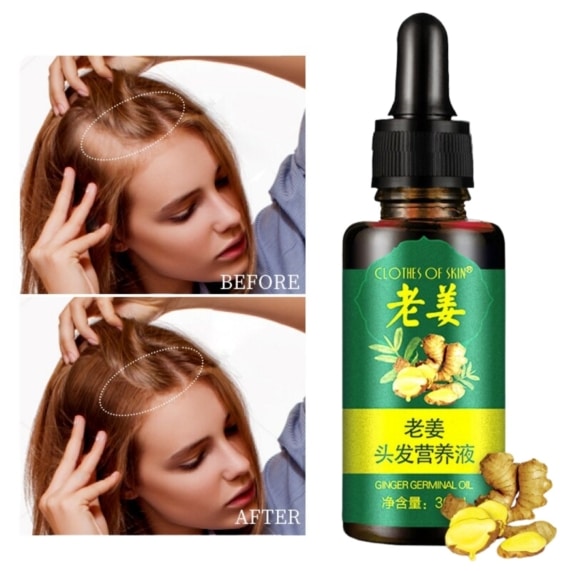 Ginger Hair Growth Serum - Promote Healthy Hair Growth - SHOPPE.LK