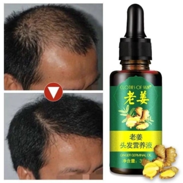 Ginger Hair Growth Serum - Promote Healthy Hair Growth - Image 3