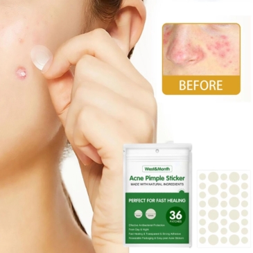 Acne Pimple Patch Sticker 36Pcs – Invisible & Fast Healing Acne with Natural Ingredients - SHOPPE.LK