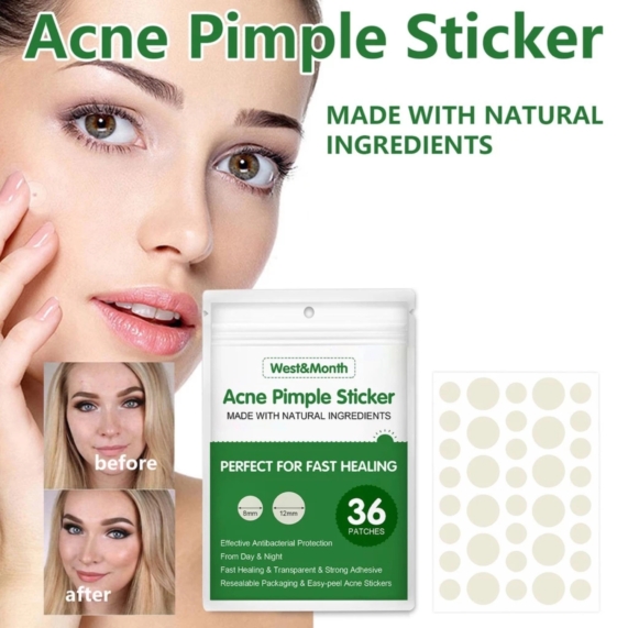 Acne Pimple Patch Sticker 36Pcs – Invisible & Fast Healing Acne with Natural Ingredients - SHOPPE.LK