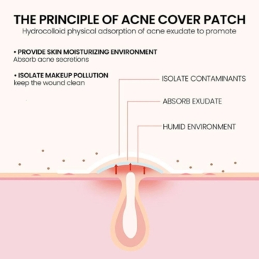 JAYSUING Acne Pimple Patch - Professional Grade 200Pcs - SHOPPE.LK