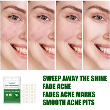 Acne Pimple Patch Sticker 36Pcs – Invisible & Fast Healing Acne with Natural Ingredients - SHOPPE.LK