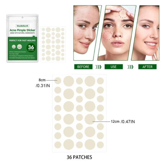 Acne Pimple Patch Sticker 36Pcs – Invisible & Fast Healing Acne with Natural Ingredients - SHOPPE.LK