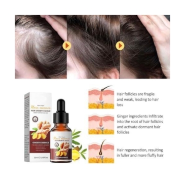 SADOER Ginger Hair Growth Serum 30ml - Powerful Nutrient Boost for Thicker Hair - Image 2