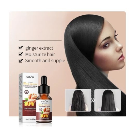 SADOER Ginger Hair Growth Serum 30ml - Powerful Nutrient Boost for Thicker Hair - SHOPPE.LK