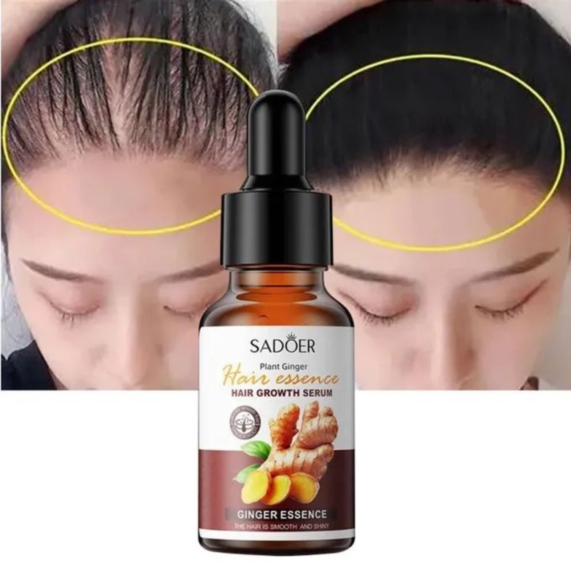 SADOER Ginger Hair Growth Serum 30ml - Powerful Nutrient Boost for Thicker Hair - SHOPPE.LK